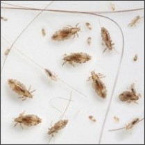 Head Lice Pictures: What Do Lice Look Like? http://www.healthline.com/health-slideshow/what-do-head-lice-look-like#2